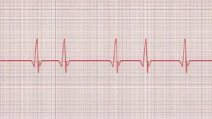 Read more about the article What Does Borderline ECG Mean+Example (2026) ❤️‍🩹